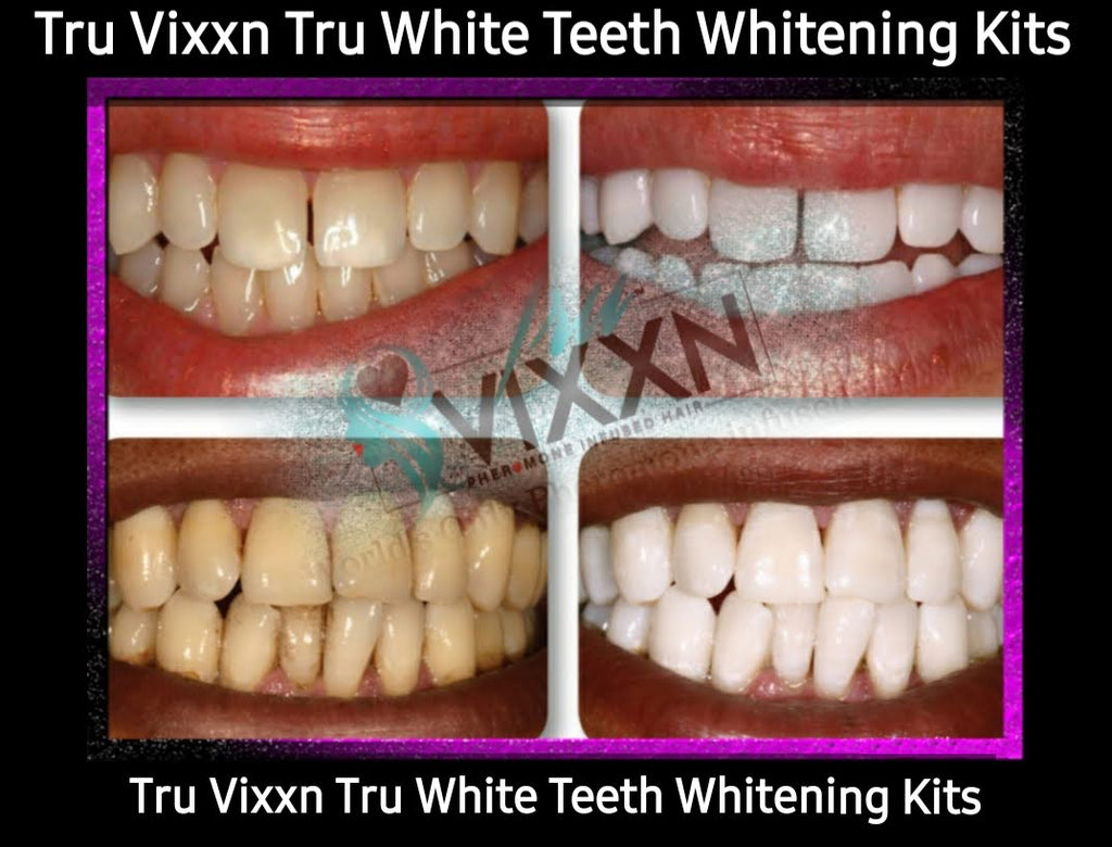 Tru Vixxn Pheromone: Tru Teeth Whitening Kit - Your Dazzling Smile Starts Here